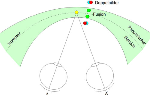 Abbildung 8: Fixationspunkt (gelb) mit Nebenpunkten im Panumraum (grün) (Jäger 2006)